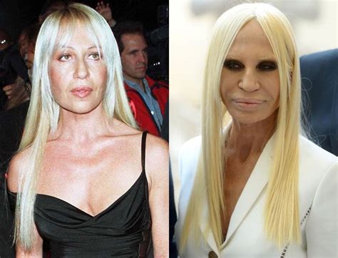 donatella versace ramona versace|donatella versace before and after surgery.